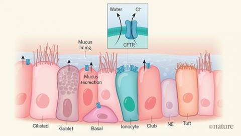 A new type of cell could change the focus of CF research